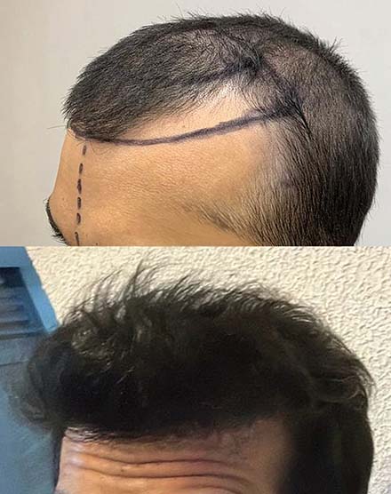 440x556